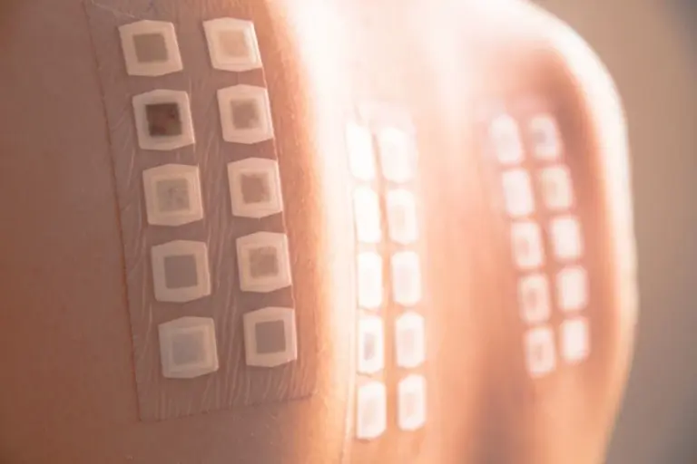 Ilustrasi patch test skincare dilakukan secara berasingan pada bahagian belakang badan bagi menguji setiap produk satu per satu sebelum penggunaan penuh