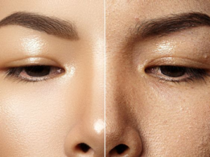makeup patchy